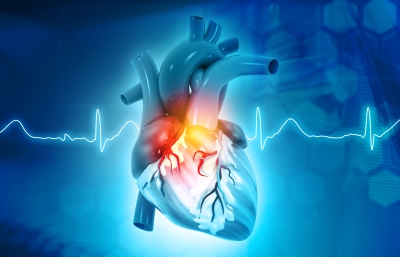 ECG